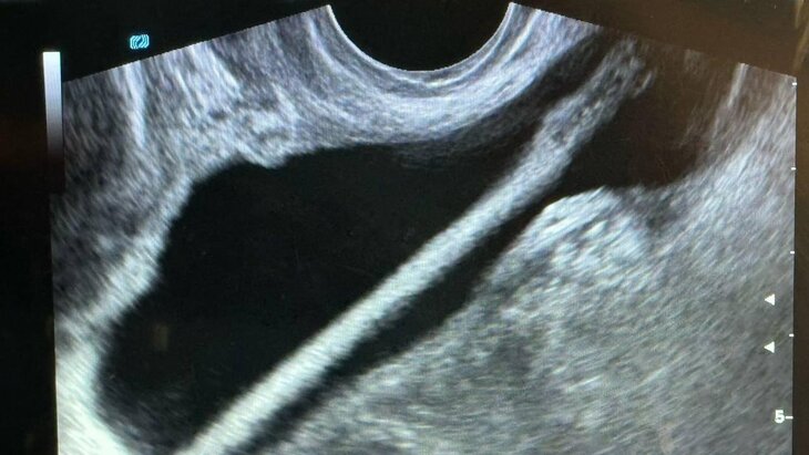 ������������ ����� �������� �� �������� ������ ������� ������������� ��������