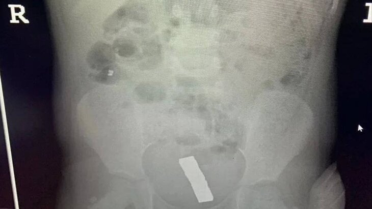 ������������ ����� ������ �������, ������������ 20 ��������